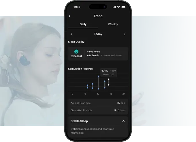 The BeCozU app's trend screen, with the sleep score you gave the night and the day's stimulation records